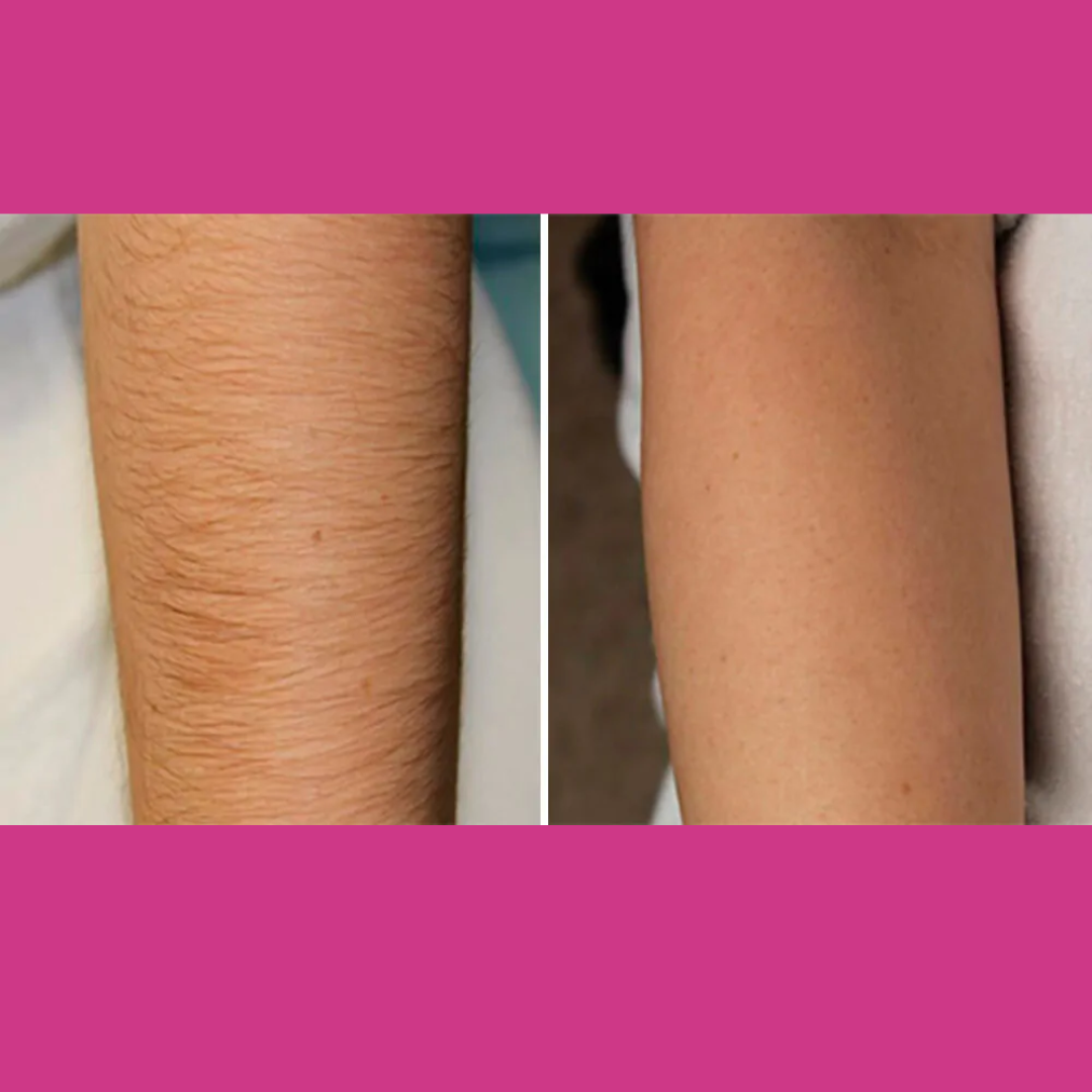 Herbal Hair Removal Wax Powder
