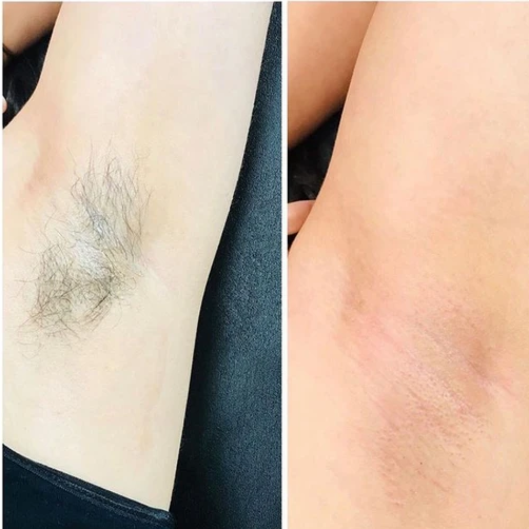 Herbal Hair Removal Wax Powder