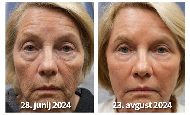 Bee Venom Firming & Anti-Wrinkle Face Cream