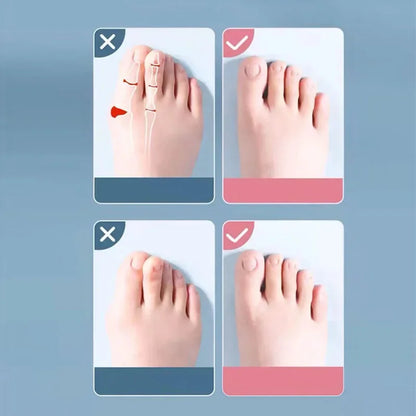 Soft Gel Toe Separator – Pain Relief & Foot Support