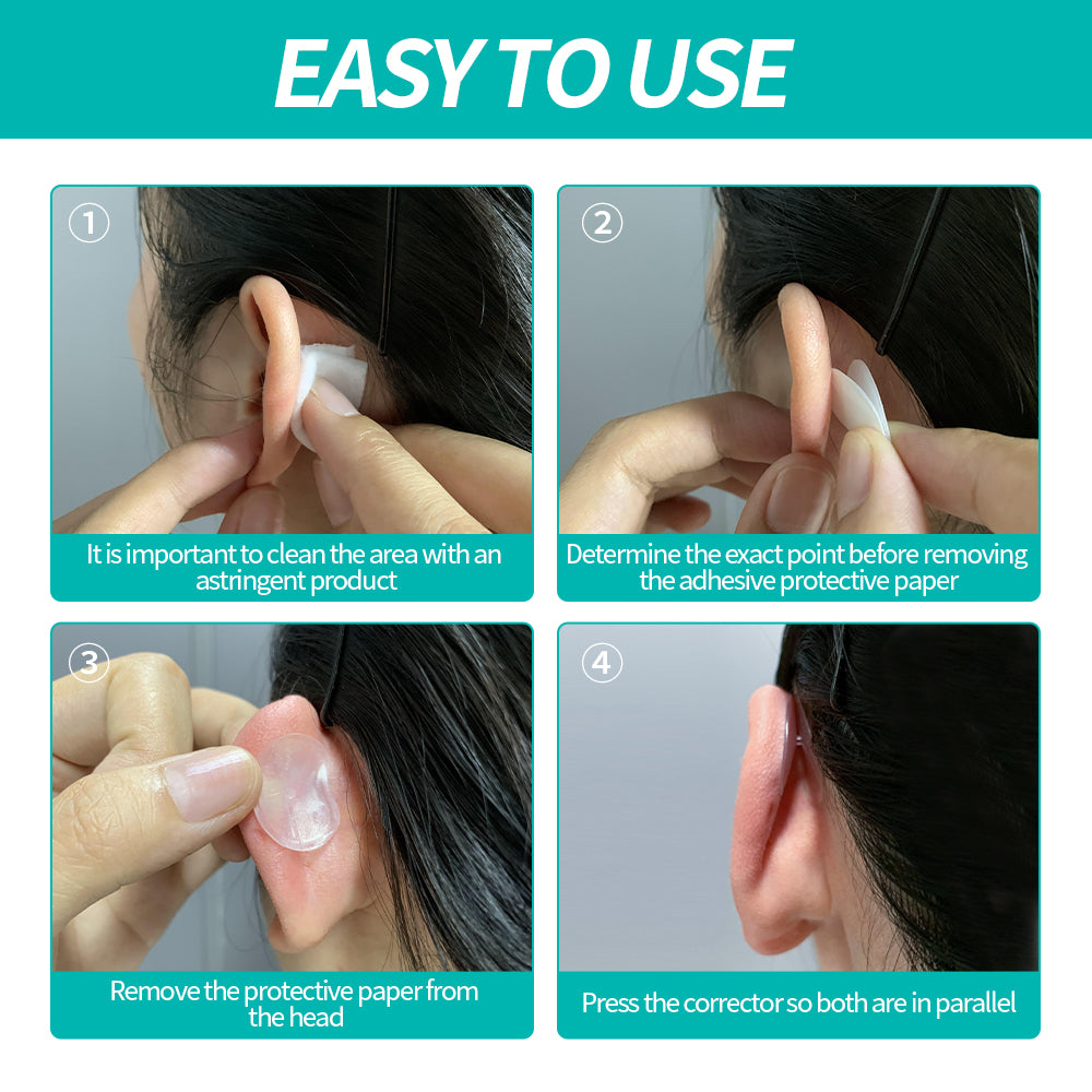Reuseable Invisible Ear Stickers for Protruding Ears
