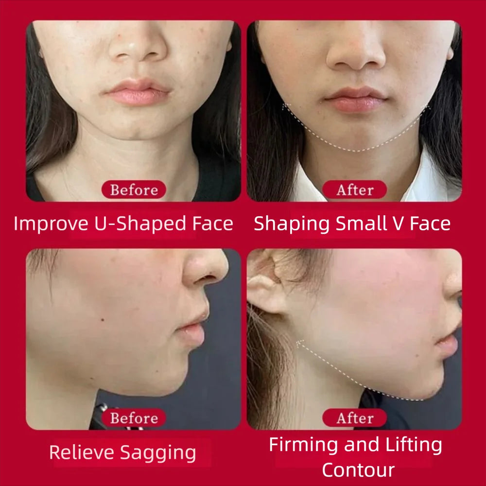 V-Shape Face Lifting Mask – Lift & Define Jawline