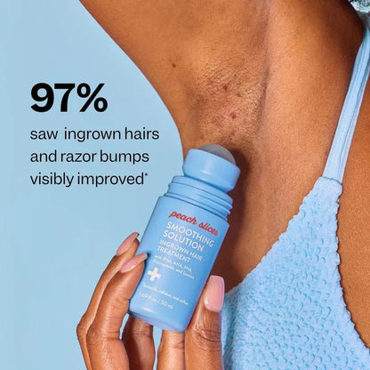Peach Slices Smoothing Solution Ingrown Hair Treatment