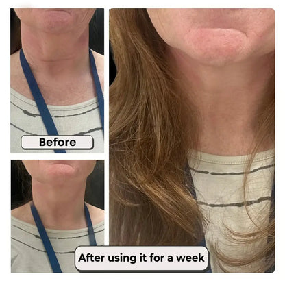 Invisible Neck Lift & Wrinkle Correction Tape