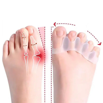 Soft Gel Toe Separator – Pain Relief & Foot Support