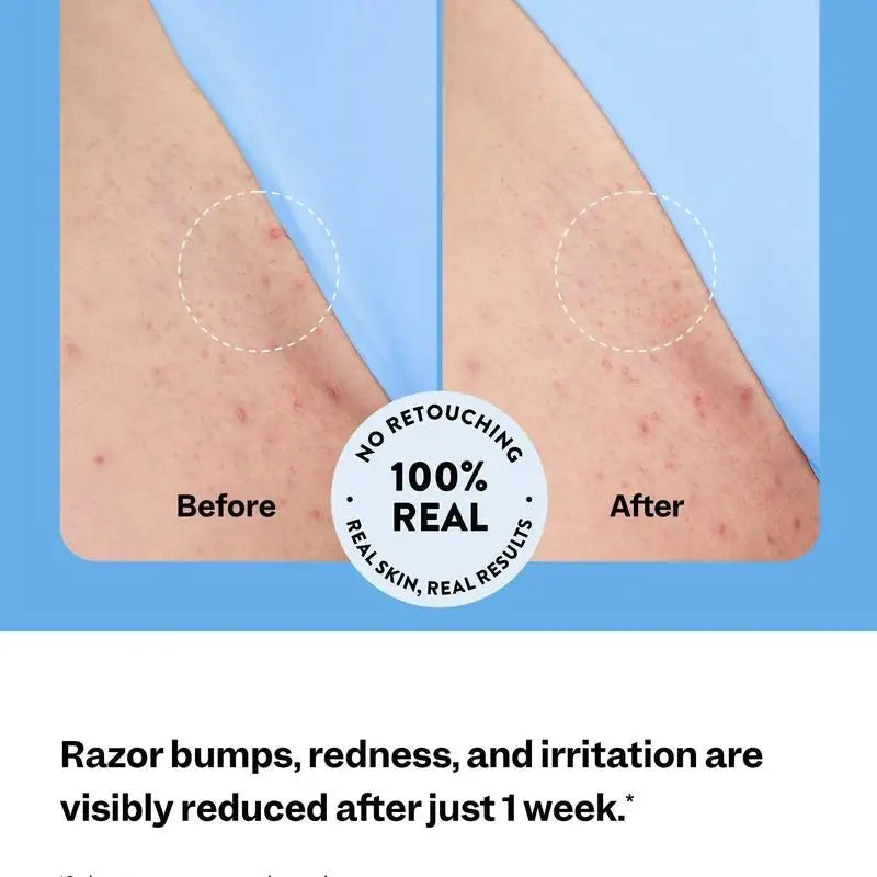 Peach Slices Smoothing Solution Ingrown Hair Treatment