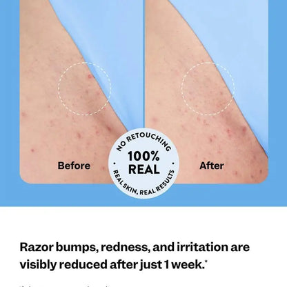 Peach Slices Smoothing Solution Ingrown Hair Treatment