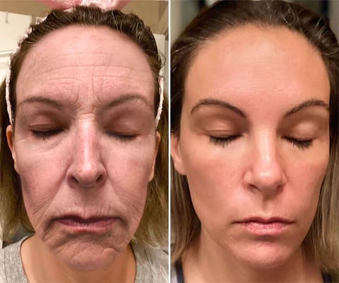 Bee Venom Firming & Anti-Wrinkle Face Cream
