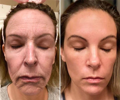 Bee Venom Firming & Anti-Wrinkle Face Cream