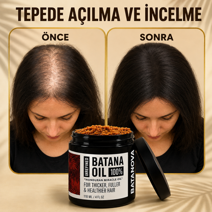 Natural Batana Re-Growth Hair Oil