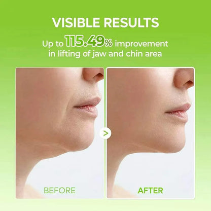 V-Shape Face Lifting Mask – Lift & Define Jawline